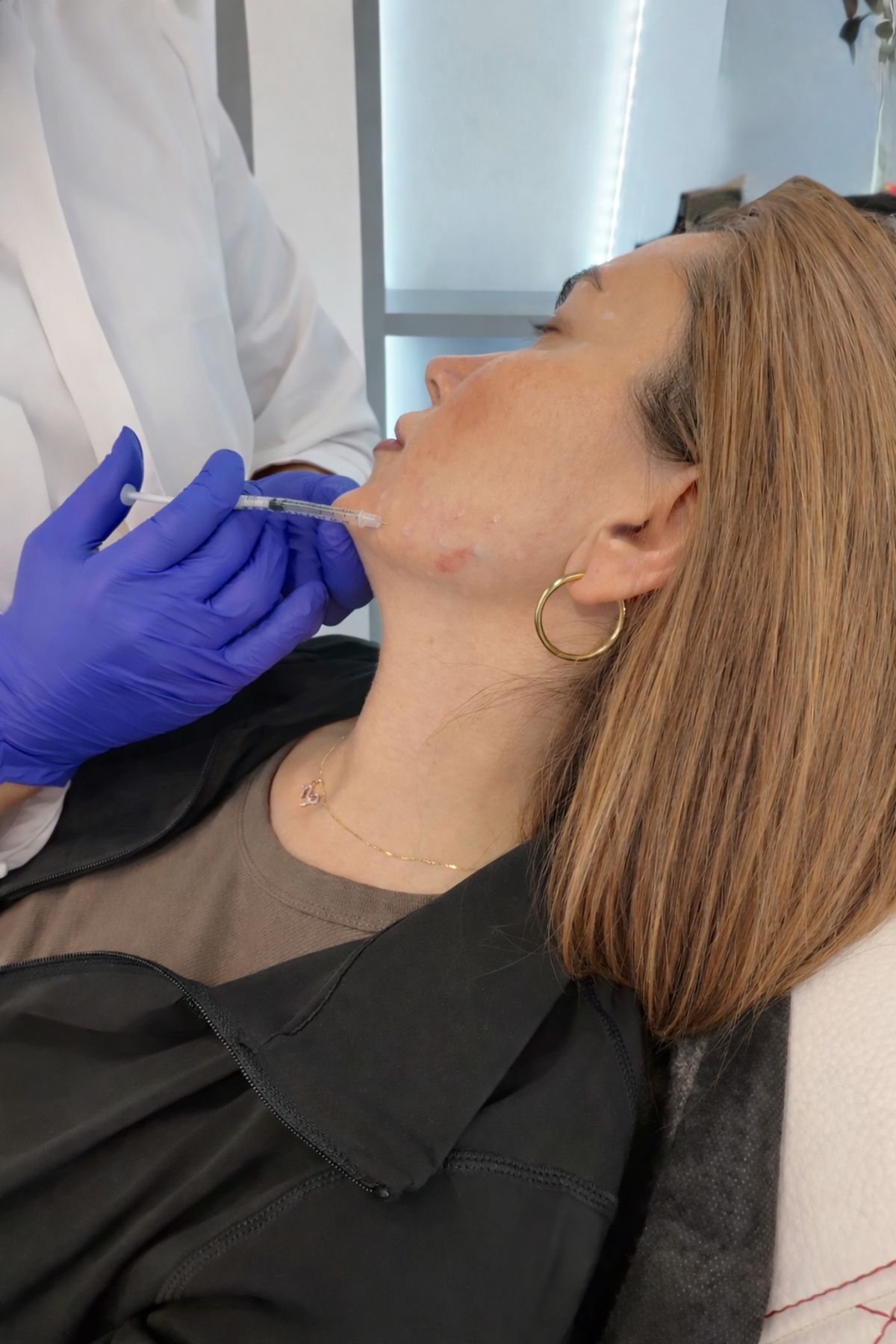 Botulinum toxin application