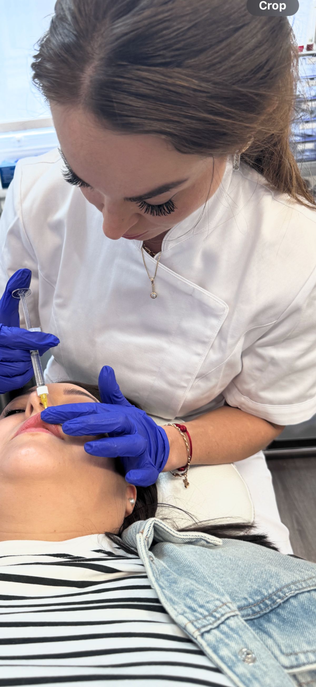 Filler application — treatment