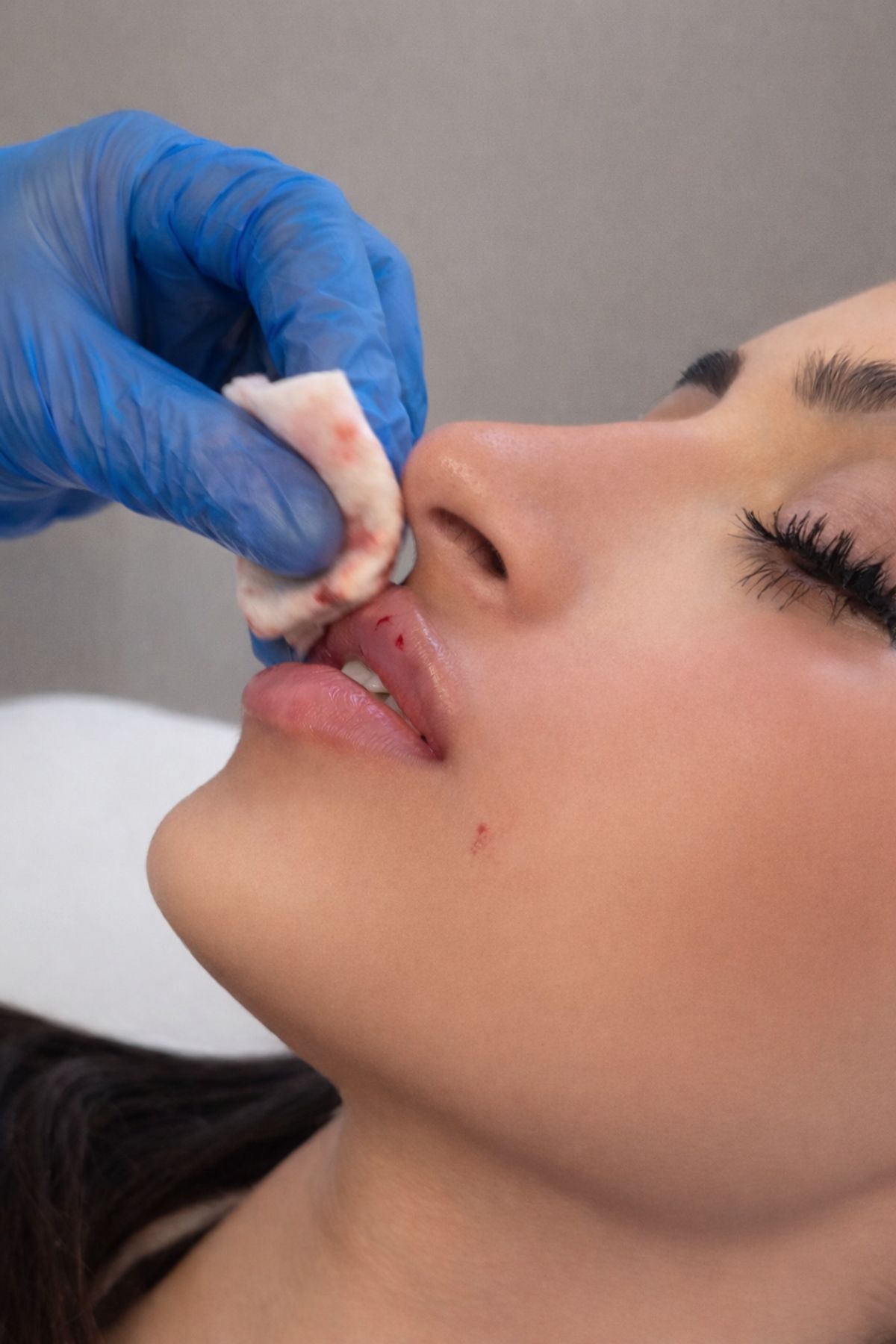Lip treatment — detail
