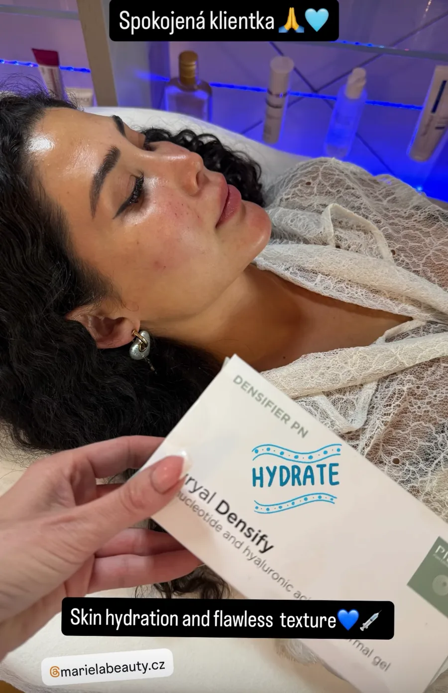 Klientka po ošetření skinboosterem v salonu Marie La Beauty
